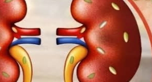 Exploring 5 Common Spices That May Support Kidney Health in Your Daily Routine