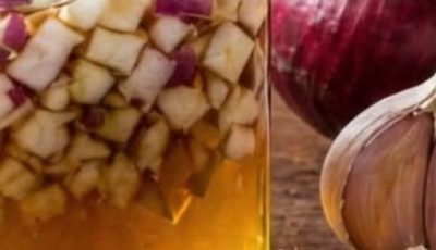 Ginger, Onion, Garlic, Lemon & Honey Remedy: Benefits, Recipe
